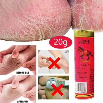 1Pcs 20g lóolaj bőrkrém repedésgátló kenőcs megakadályozza a száraz bőrt Hidratál véd Véd Ujjak, lábak és bőrápolási termékek