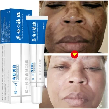 Hatékony fehérítő szeplős arckrém Távolítsa el a sötét foltokat Fade Melasma melanin hidratáló ragyog Javítja a fakóságot Bőrápolás